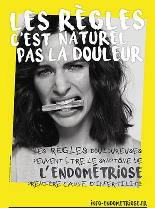 Endometriose regles douloureuses Resendo Paris